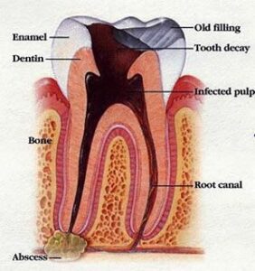 Tooth Structure and Toothache