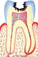 Tooth structure and toothache