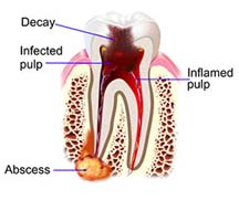 Tooth structure and toothache