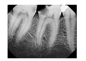 tooth pain and patient fear