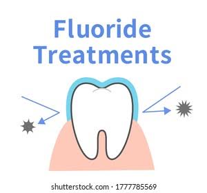 Cavity treatment 